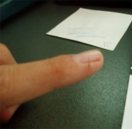 cutfinger.jpg