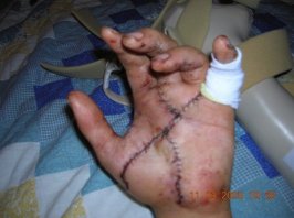 matts hand 4.jpg