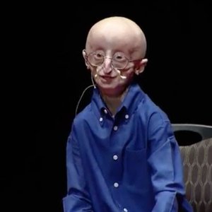 My philosophy for a happy life | Sam Berns